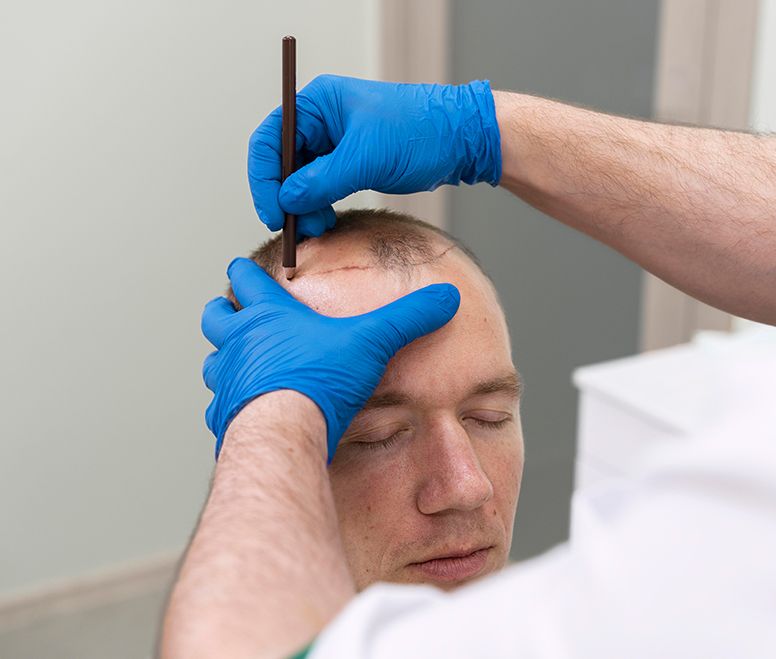 laser hair removal - faq
